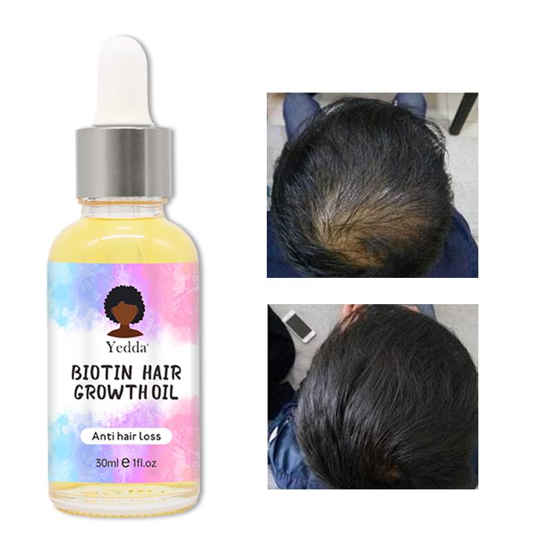 Yedda Anti Hair Loss Biotin Hair Oil